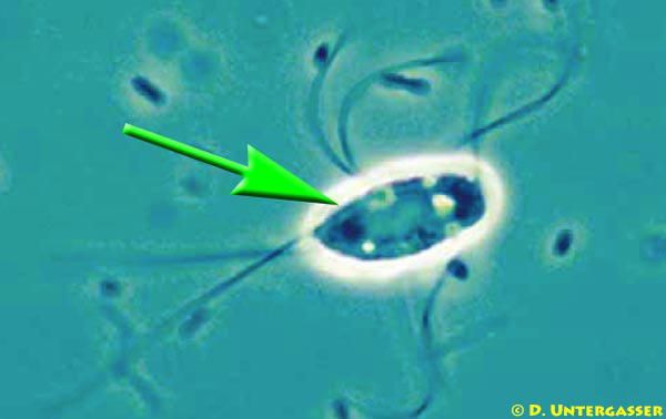 darmflagellaten-spironucleus-hexamita-neu