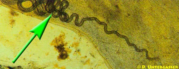 haarwuermer-fische-capillaria-2-neu